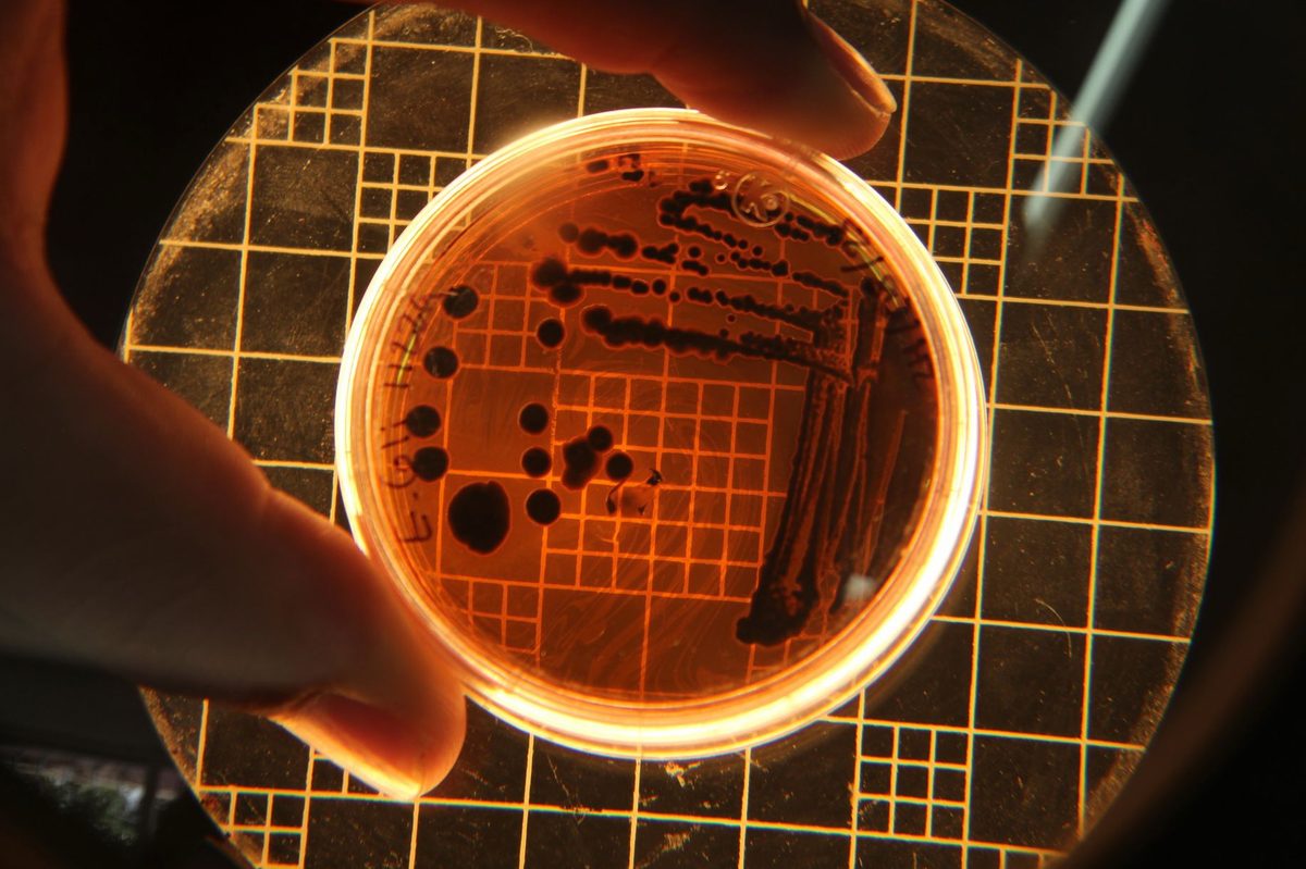 Colonii bacteriene pe o placă de laborator, cultură folosită la identificarea E. coli